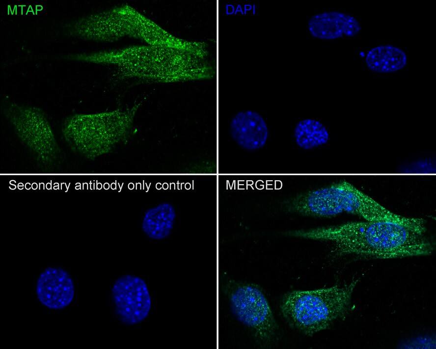 MTAP Antibody (JE63-74)
