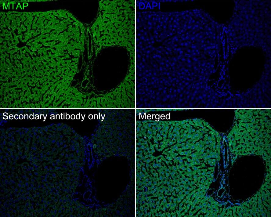MTAP Antibody (JE63-74)