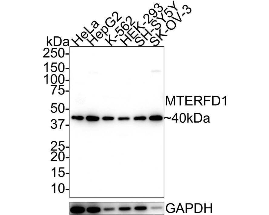 MTERFD1 Antibody (A8-A10-R)