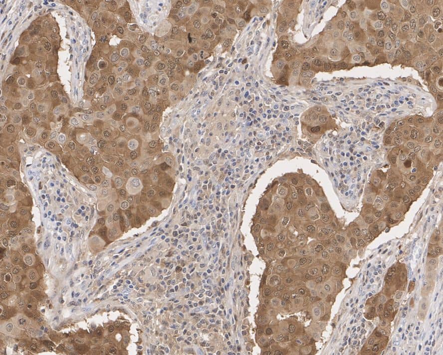 MTH1 Antibody (PSH02-40)