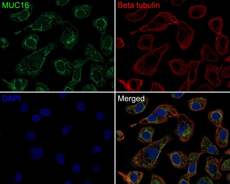 CA125/MUC16 Antibody (PD01-13)