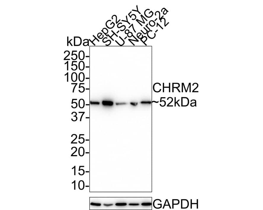 Muscarinic Acetylcholine Receptor M2/CHRM2 Antibody (JE38-35)