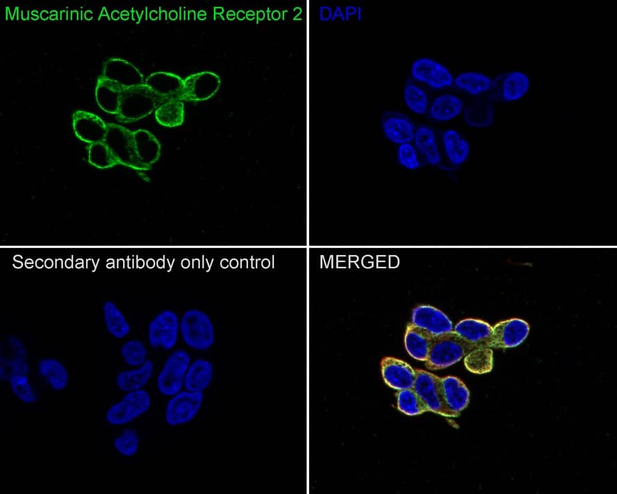 Muscarinic Acetylcholine Receptor M2/CHRM2 Antibody (JE38-35)