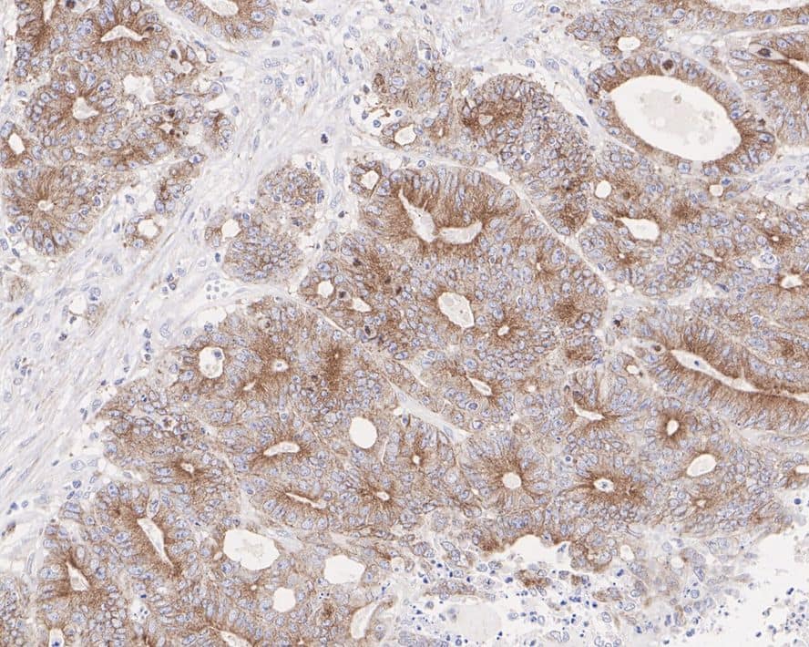 Muscarinic Acetylcholine Receptor M2/CHRM2 Antibody (JE38-35)