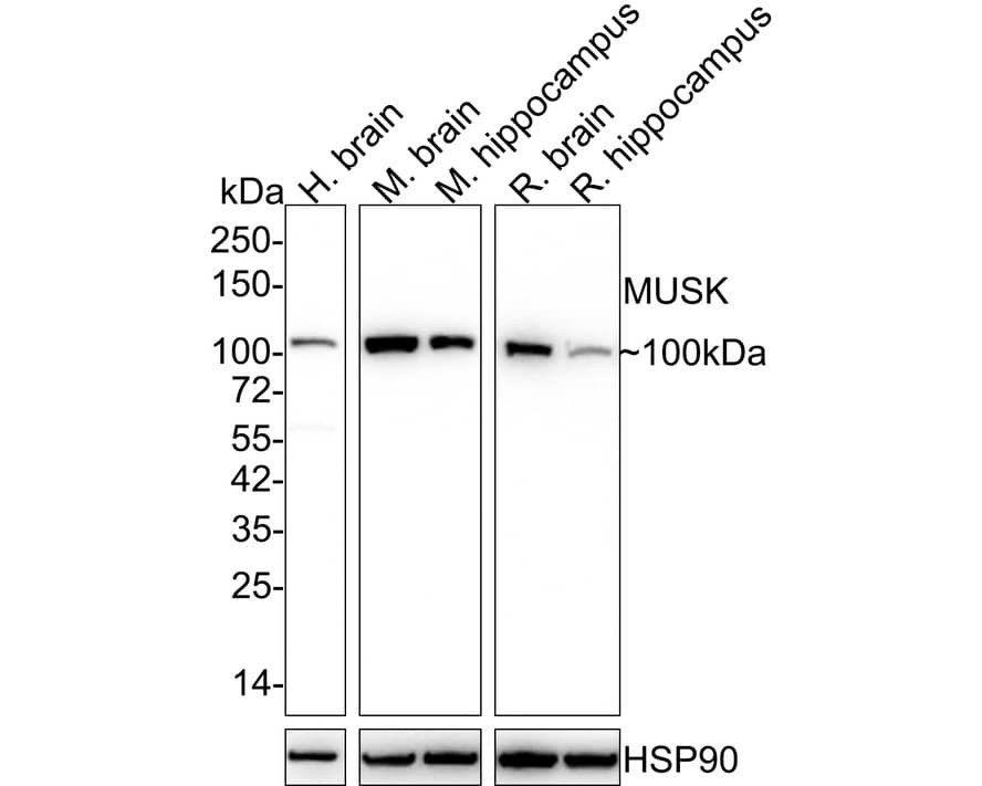 MuSK Antibody (PSH02-28)