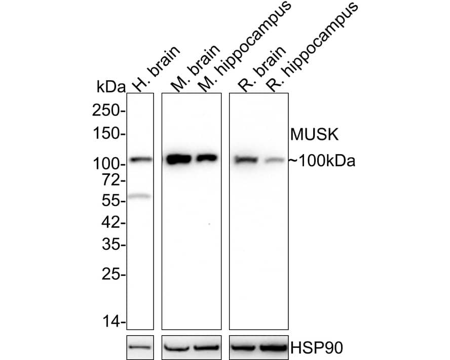 MuSK Antibody (PSH02-29)