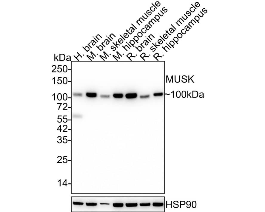 MuSK Antibody (PSH03-51)