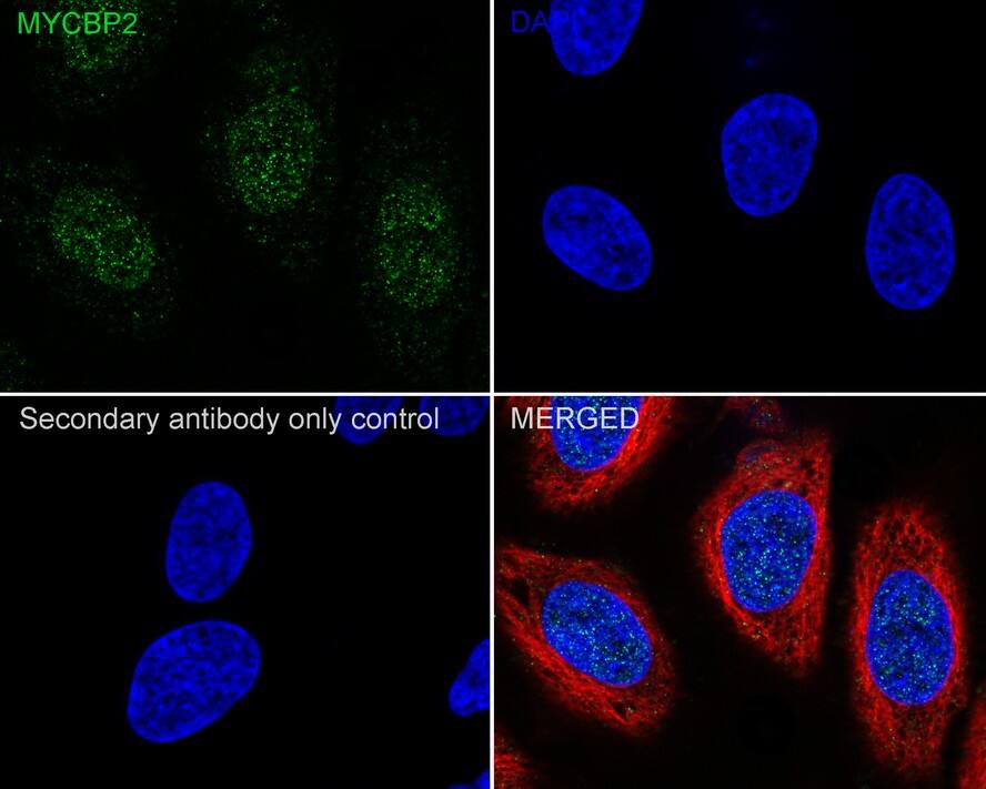 MYCBP2 Antibody (PSH03-68)