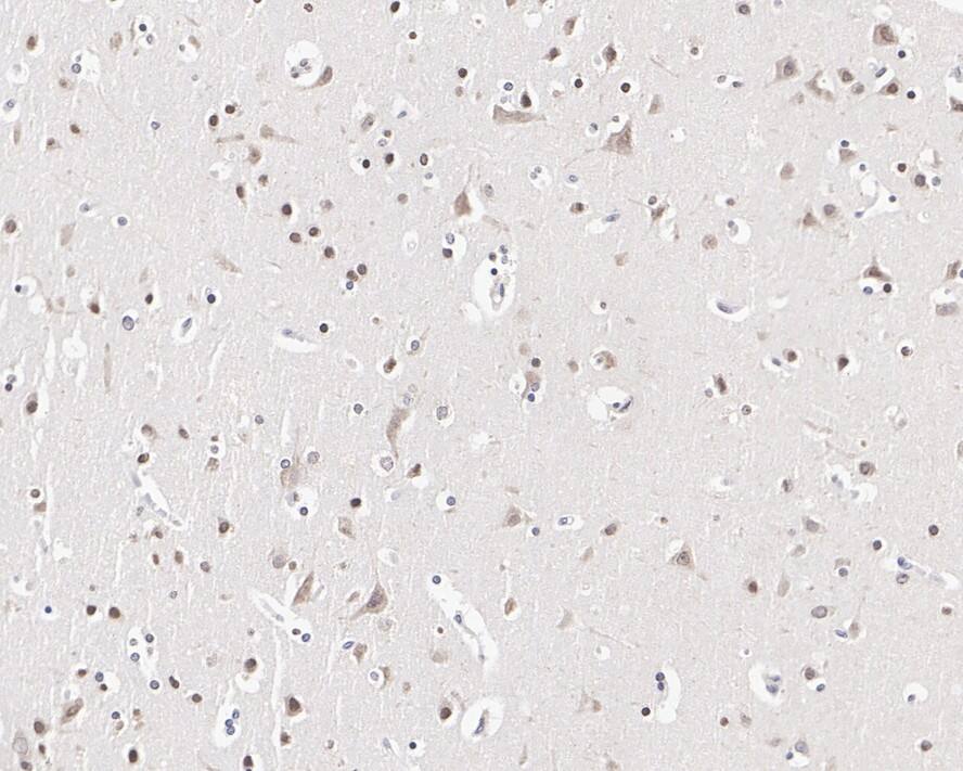 MYCBP2 Antibody (PSH03-68)