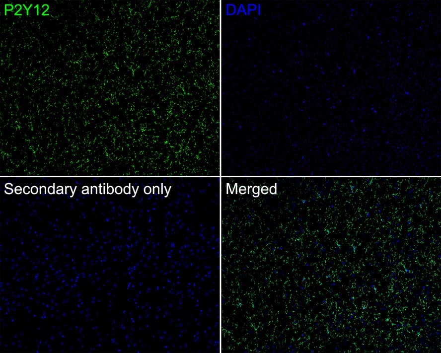 P2Y12/P2RY12 Antibody (PSH04-48)