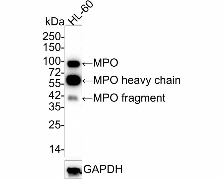 Myeloperoxidase/MPO Antibody (A1F2-R)