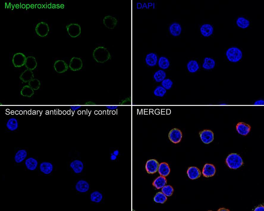 Myeloperoxidase/MPO Antibody (A1F2-R)
