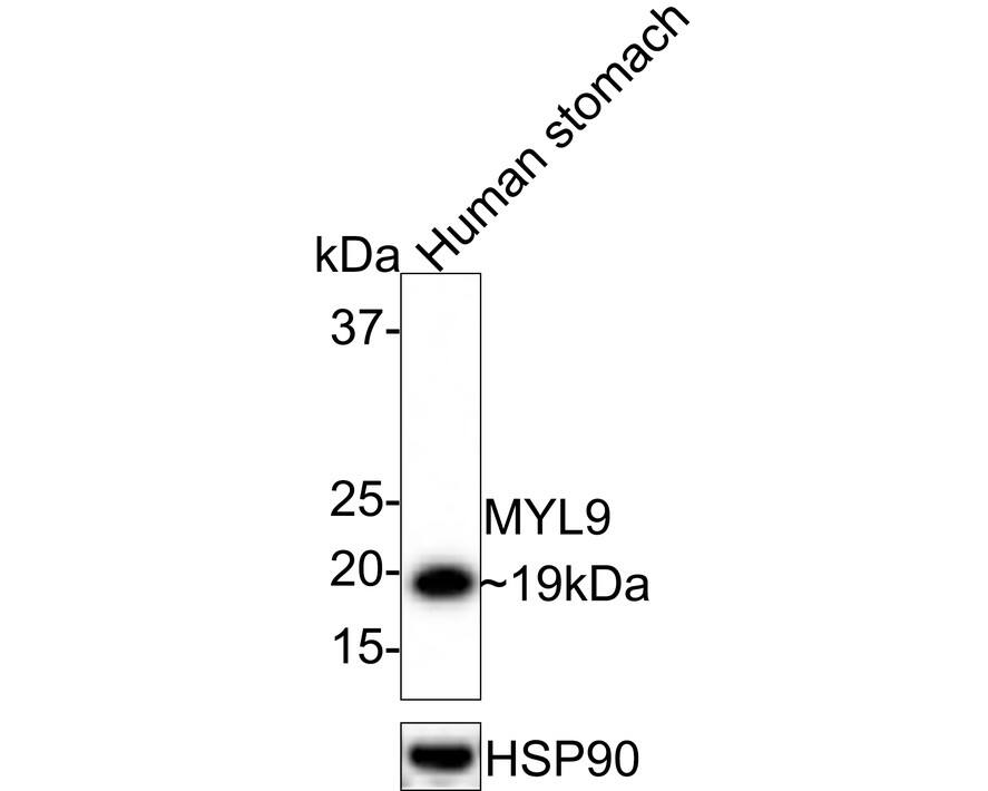 MYL9 Antibody (JE34-63) Western Blot: MYL9 Antibody (JE34-63) [NBP3-32626]