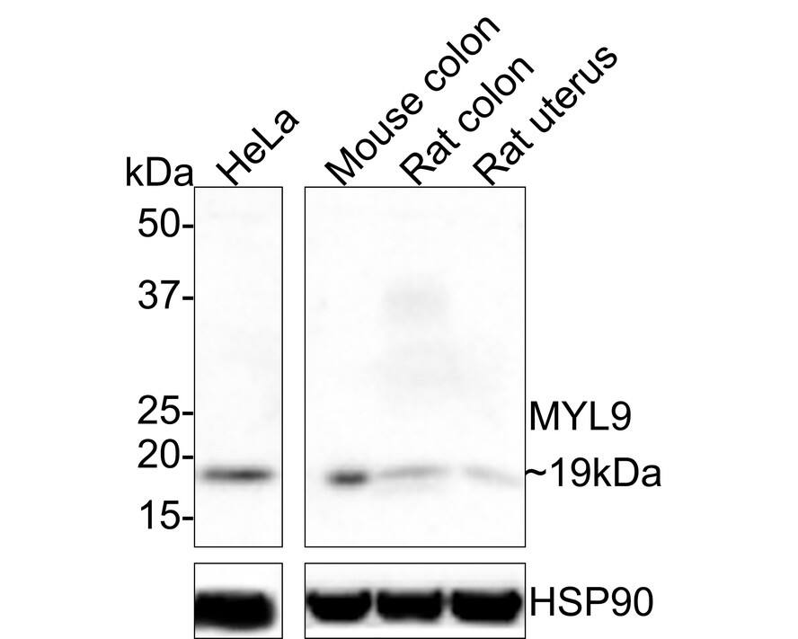 MYL9 Antibody (JE34-63)