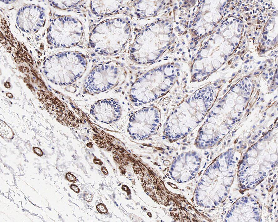 MYL9 Antibody (JE34-63)