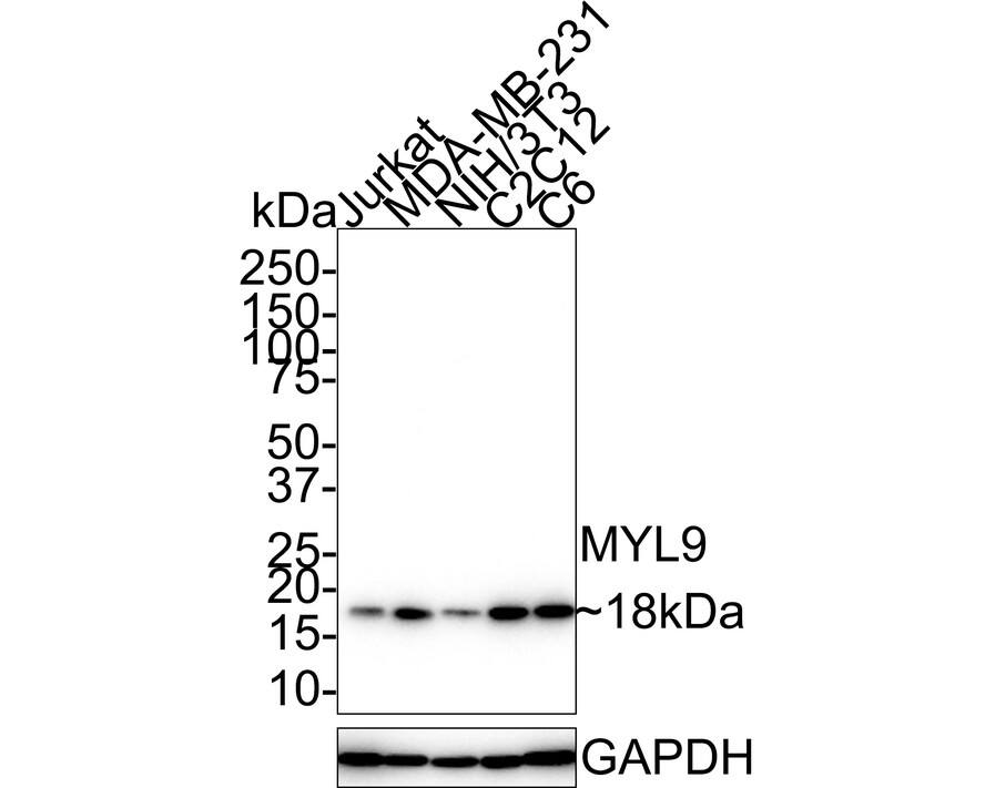 MYL9 Antibody (PSH02-07) Western Blot: MYL9 Antibody (PSH02-07) [NBP3-32627]
