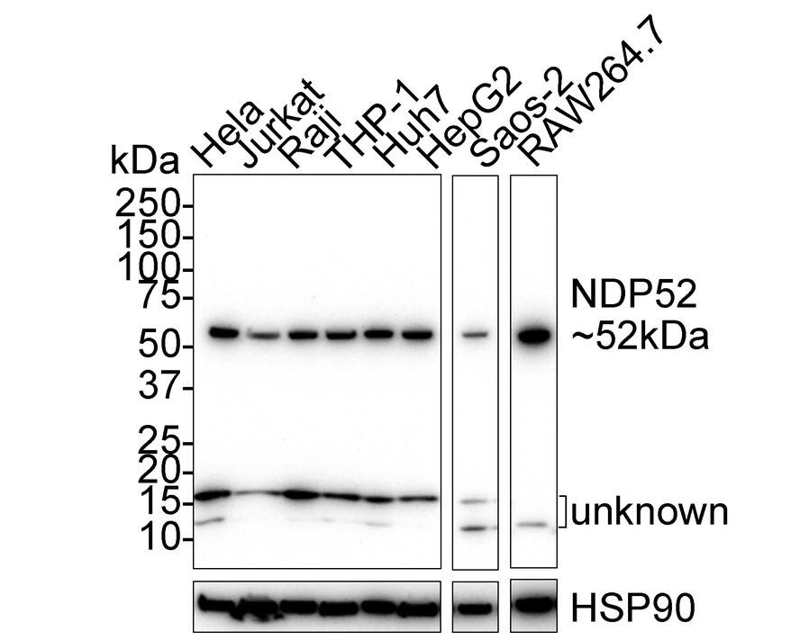 NDP52 Antibody (PSH02-33)