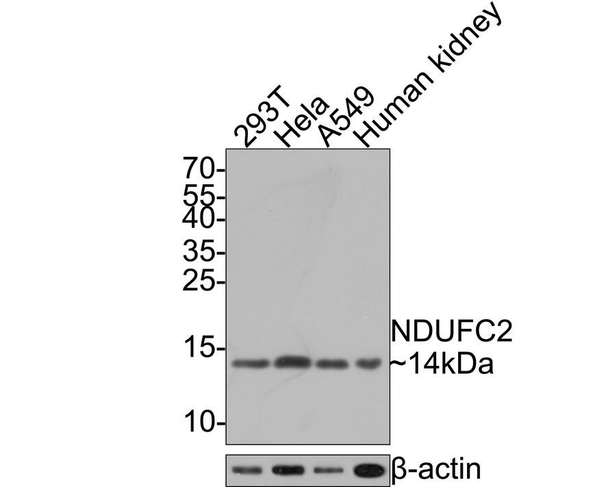 NDUFC2 Antibody (JE65-31)