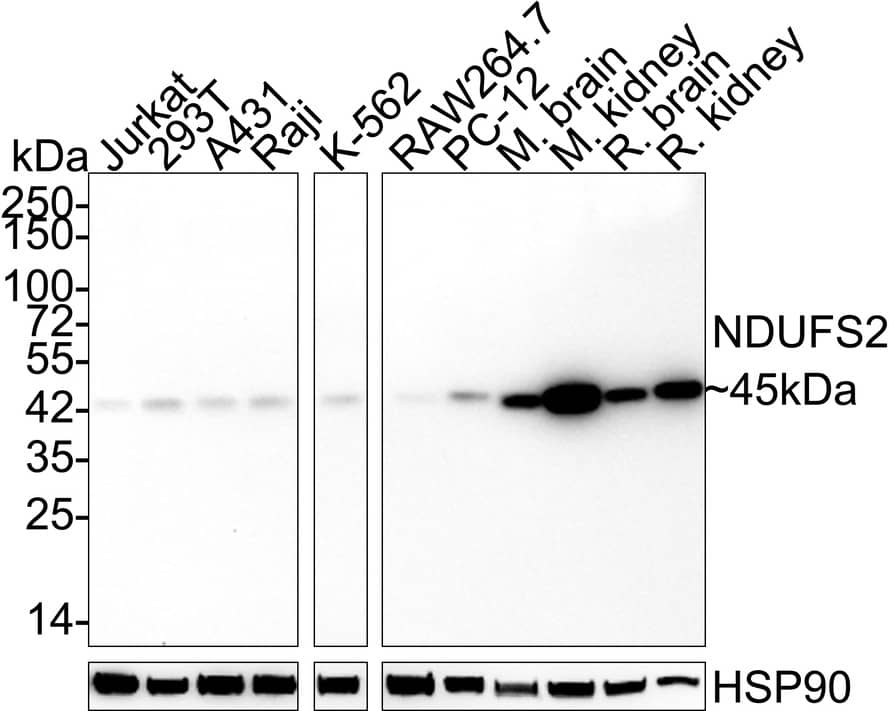 NDUFS2 Antibody (JE65-29) Western Blot: NDUFS2 Antibody (JE65-29) [NBP3-32638]