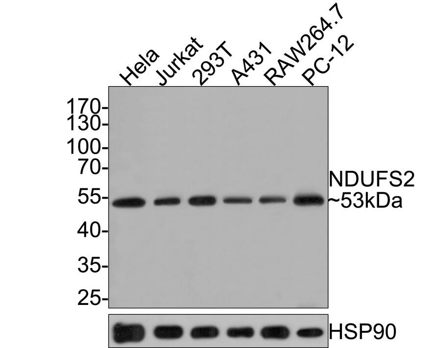 NDUFS2 Antibody (JE65-29)