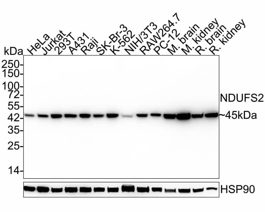 NDUFS2 Antibody (PSH03-26) Western Blot: NDUFS2 Antibody (PSH03-26) [NBP3-32639]