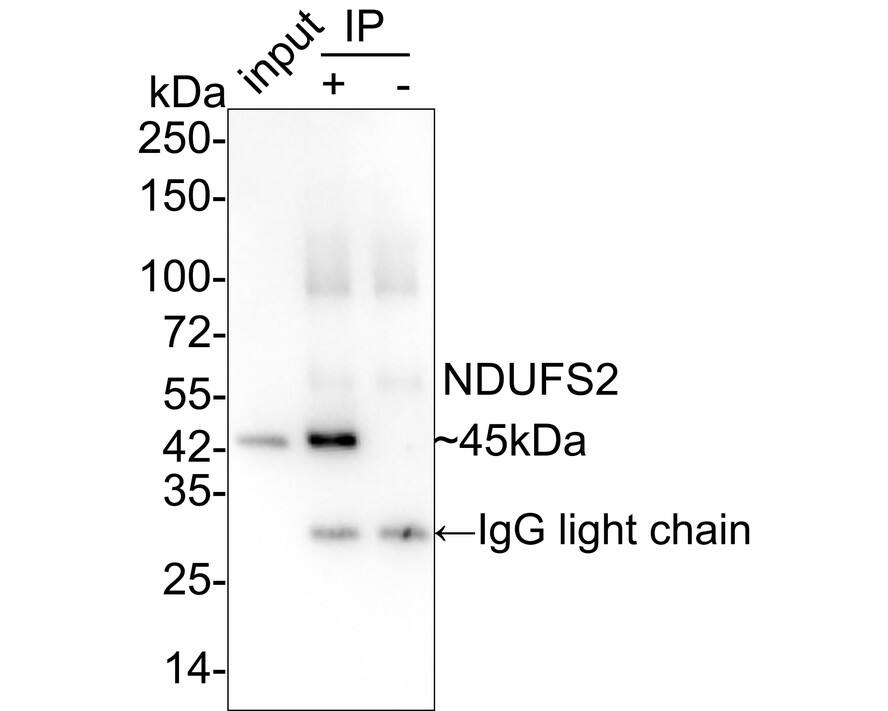 NDUFS2 Antibody (PSH03-26)