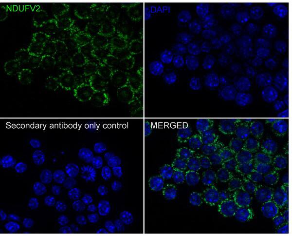 NDUFV2 Antibody (PSH02-86)