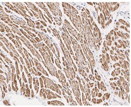 NDUFV2 Antibody (PSH02-86)