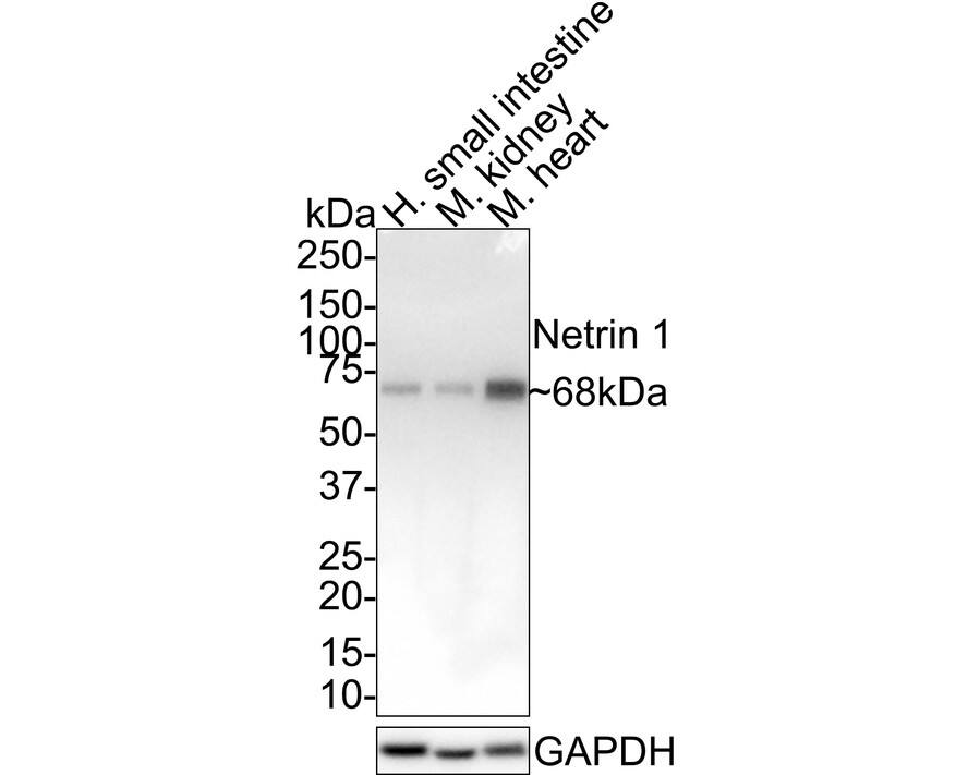 Netrin-1 Antibody (JE38-87)