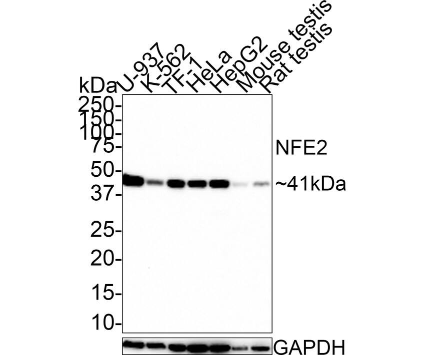 Nuclear Factor Erythroid Derived 2 Antibody (JE65-92)