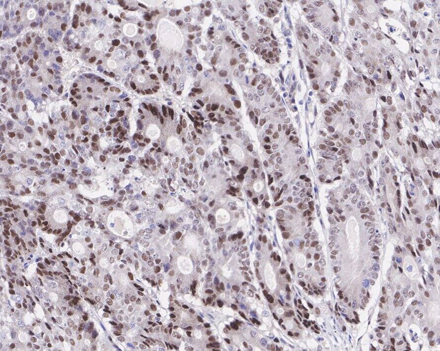 Nuclear Factor Erythroid Derived 2 Antibody (JE65-92)