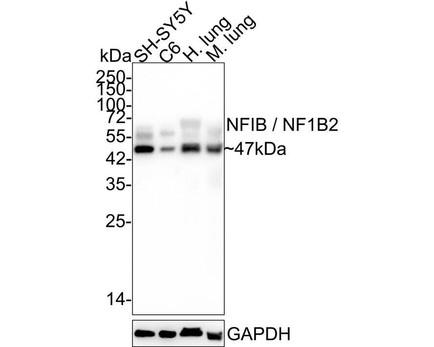 NFIB Antibody (JE35-21)