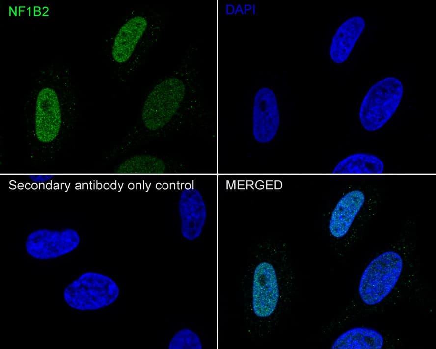 NFIB Antibody (JE35-21)