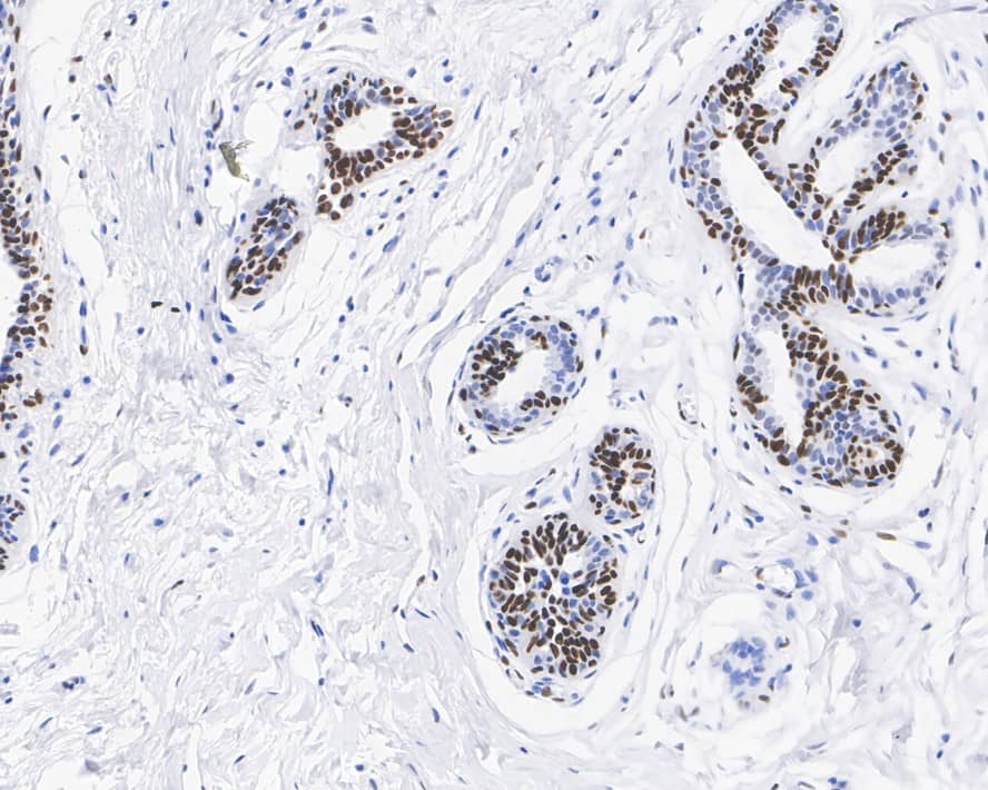 NFIB Antibody (JE35-21)