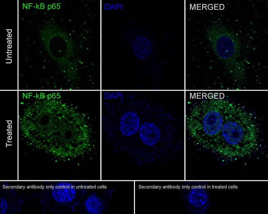 RelA/NFkB p65 Antibody (PSH0-27)