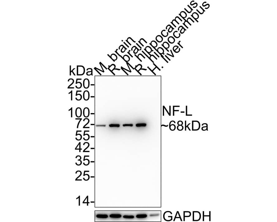 NF-L Antibody (PSH0-77)