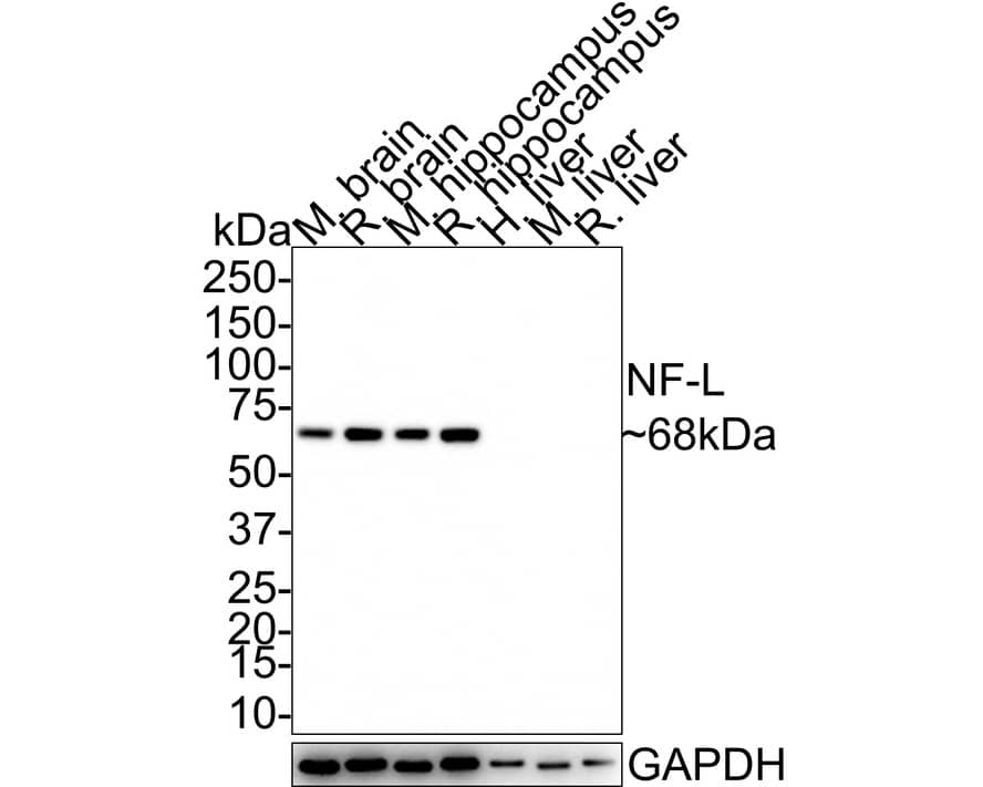 NF-L Antibody (PS02-10)