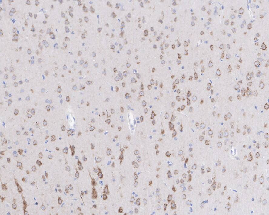 Ninein Antibody (PSH03-46)