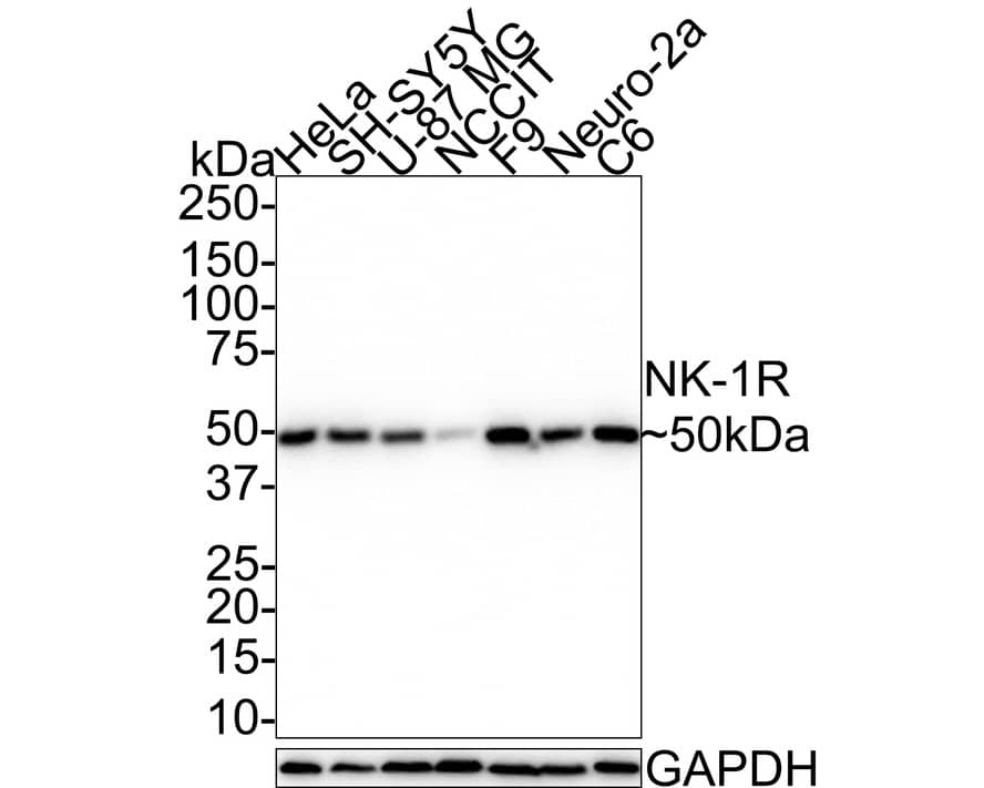 NK1R Antibody (JE39-75)