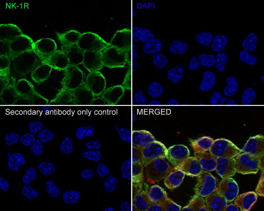 NK1R Antibody (JE39-75)