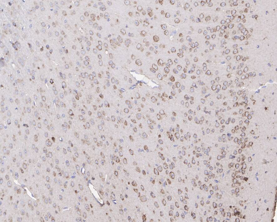 NK1R Antibody (JE39-75)