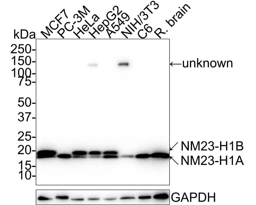 NM23-H1 Antibody (12A1-R)