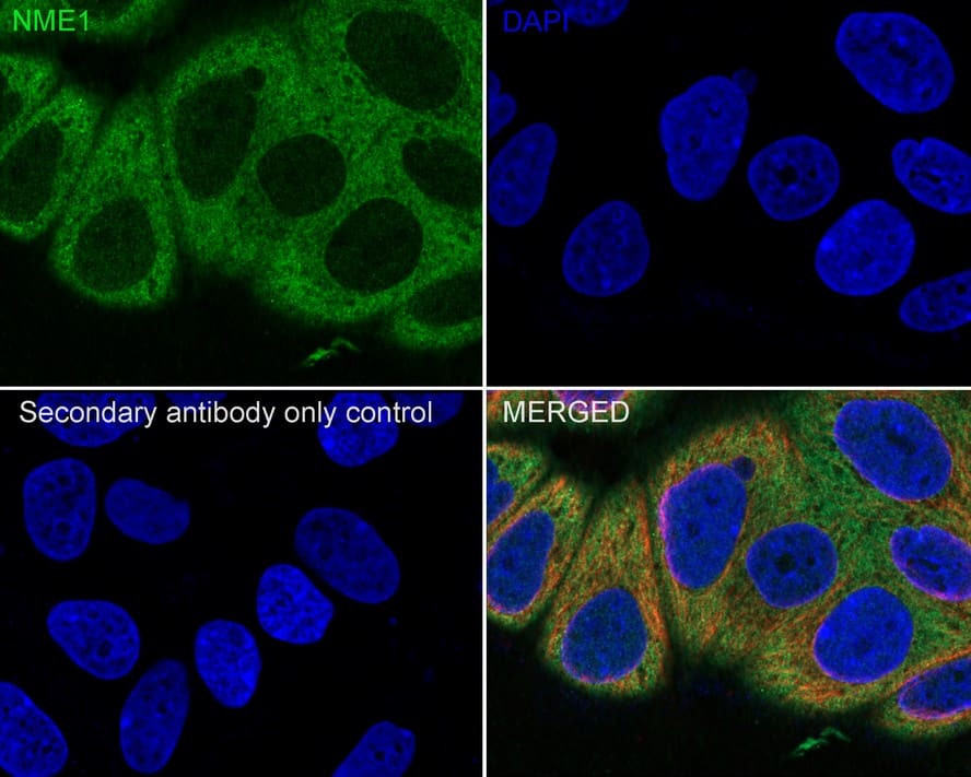 NM23-H1 Antibody (12A1-R)