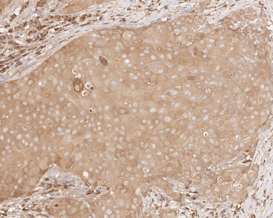 NM23-H1 Antibody (12A1-R)