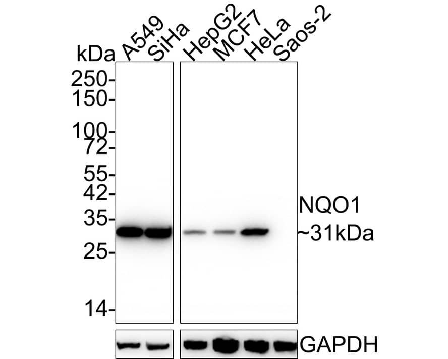 NQO-1 Antibody (13A1-R)