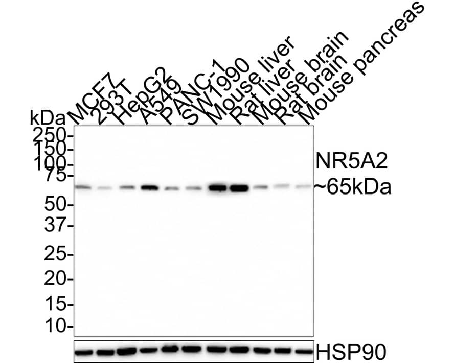 LRH-1/NR5A2 Antibody (JE30-50)