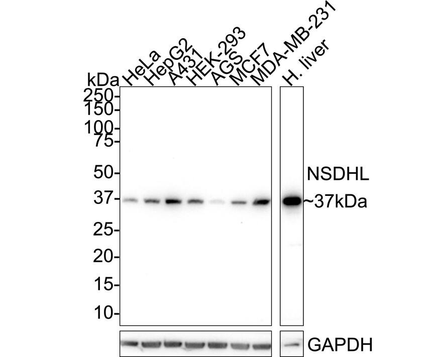 NSDHL Antibody (JE64-86) Western Blot: NSDHL Antibody (JE64-86) [NBP3-32662]