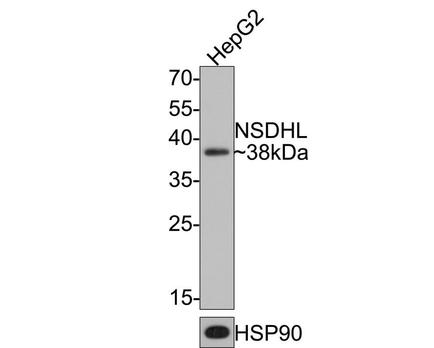 NSDHL Antibody (JE64-86)