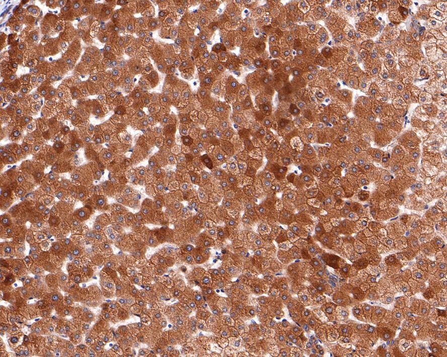 NSDHL Antibody (JE64-86)