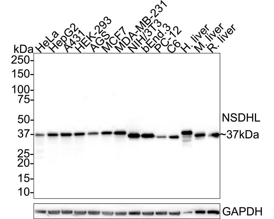 NSDHL Antibody (PSH02-36) Western Blot: NSDHL Antibody (PSH02-36) [NBP3-32663]
